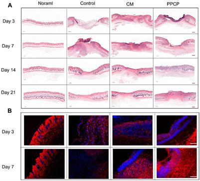 Corrigendum: “Jianbing” styling multifunctional electrospinning composite membranes for wound healing